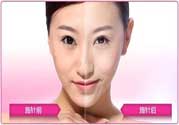 美白針真的有效嗎？美白針的危害有哪些？