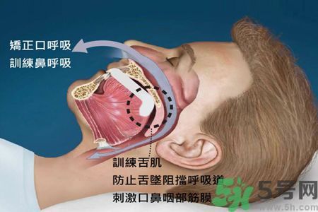 耳鳴是什么原因引起的？耳鳴怎么治療最好？