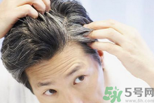 年輕人長白頭發(fā)怎么辦？年輕人長白頭發(fā)是什么原因？