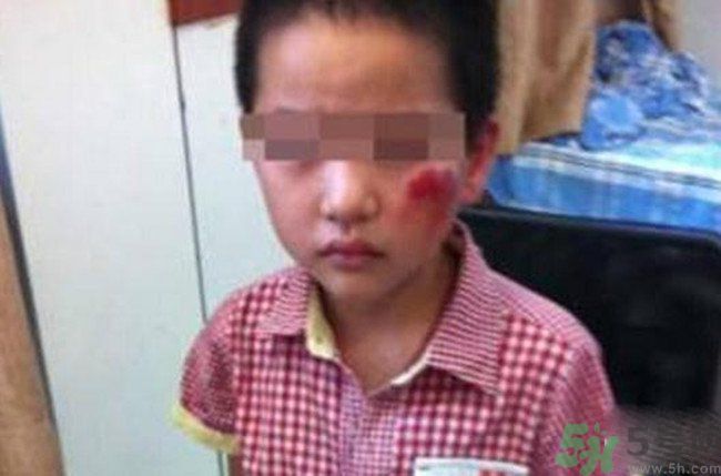 男孩遭校長暴打的結(jié)果是什么？男孩遭校長暴打的真相是什么？