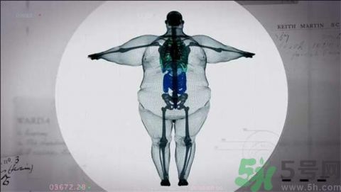 900斤胖子X光掃描照片驚人 過度肥胖會(huì)有什么危害? 900斤胖子X光掃描照片驚人 過度肥胖會(huì)有什么危害?