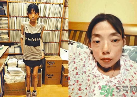 富二代離婚娶二線女星前妻瘦成骷髏  怎么選擇有責(zé)任的男人？