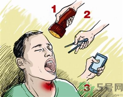 魚(yú)刺卡喉喝醋可以治療嗎？魚(yú)刺卡喉喝醋好不好？