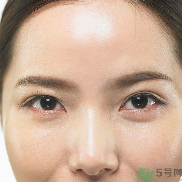 眉周紋是怎么形成的？眉周紋怎么去除？