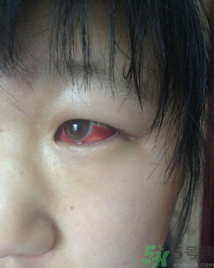 初中生全體甲醛中毒是怎么回事？初中生全體甲醛中毒是哪個學校？