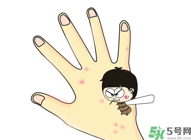 蚊子叮的包過幾天又癢是為什么？蚊子叮的包過幾天又癢怎么辦？