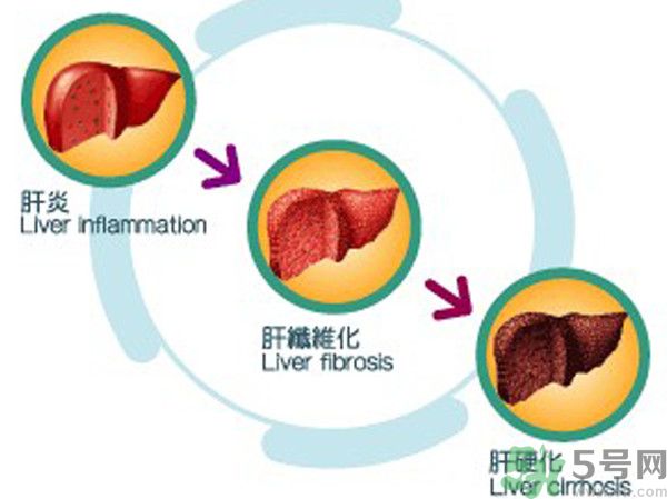 在外面吃飯會(huì)得乙肝嗎？在食堂吃飯會(huì)得乙肝嗎？