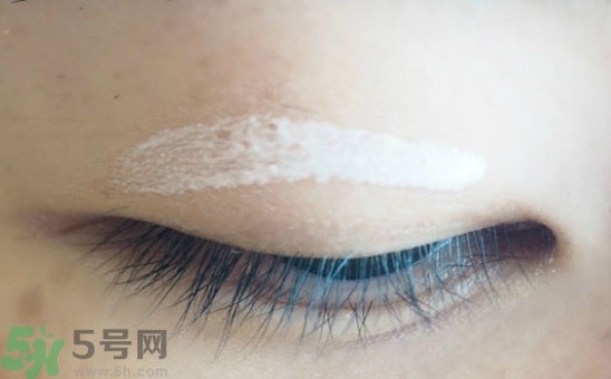 單眼皮怎么變雙眼皮了？單眼皮上面有一條線