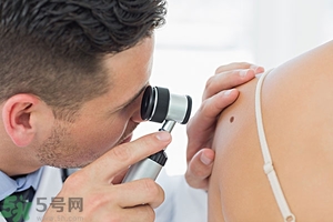 臉上長(zhǎng)痣是什么原因？臉上為什么會(huì)長(zhǎng)痣？