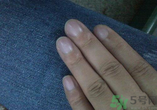 指甲發(fā)紫是什么原因？指甲發(fā)紫是怎么回事？