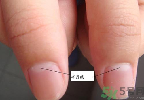 指甲沒有月牙是什么原因？指甲沒有月牙怎么調(diào)理？
