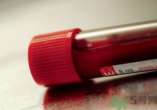 獻(xiàn)血后可以洗澡嗎？抽血后可以洗澡嗎？