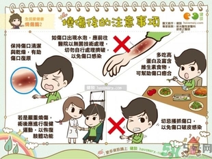 手被油燙傷了怎么處理？手被油燙起泡了怎么辦？