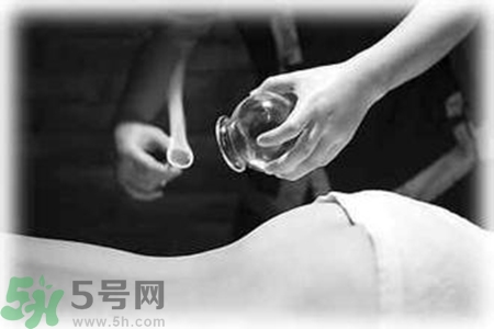 大暑可以拔罐嗎？大暑拔罐好不好？