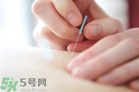 大暑可以針灸嗎？大暑針灸好不好？