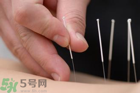 大暑可以針灸嗎？大暑針灸好不好？