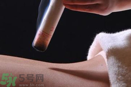大暑可以艾灸嗎？大暑艾灸的好處有哪些？