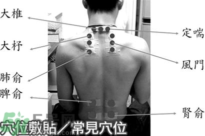 經期可以貼三伏貼嗎？來月經可以貼三伏貼嗎？