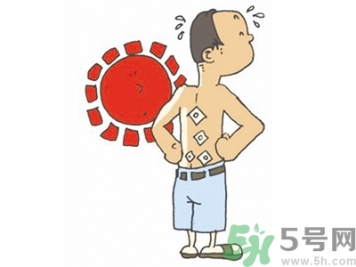 貼三伏貼癢怎么回事？貼三伏貼過敏怎么辦？