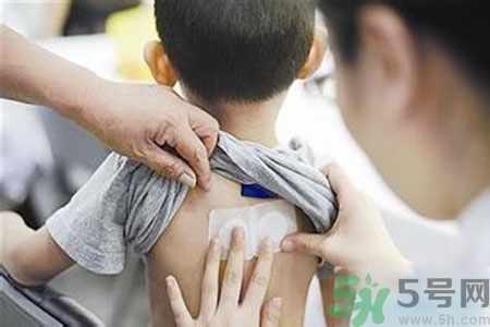 肝炎貼三伏貼有用嗎？肝病貼三伏貼貼哪里？