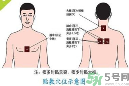 肝炎貼三伏貼有用嗎？肝病貼三伏貼貼哪里？