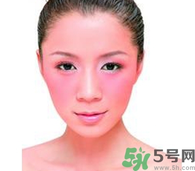 敏感性皮膚用什么洗面奶？敏感性皮膚怎么修復(fù)？