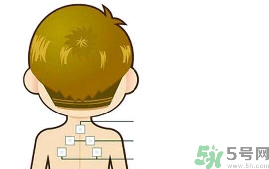 貼三伏貼可以吹空調(diào)嗎？貼完三伏貼多久后可以吹空調(diào)？