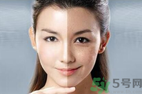 干性皮膚用什么洗面奶？干性皮膚該怎么保養(yǎng)？