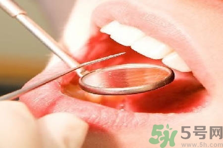 冷光美白牙齒是什么？冷光美白牙齒的好處有哪些？