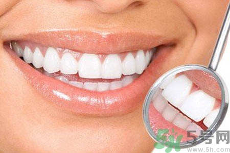 冷光美白牙齒的價(jià)格是多少？做冷光美白牙齒需要多少錢？