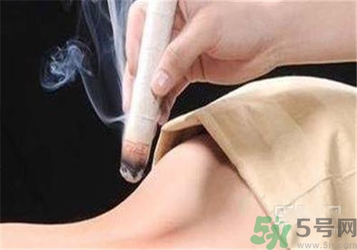 蕁麻疹可以艾灸嗎？蕁麻疹艾灸哪個(gè)穴位？