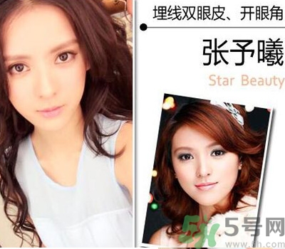 開眼角眼睛會變大嗎？開眼角眼睛能大多少？