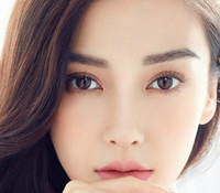 開眼角會(huì)留疤嗎？開眼角增生怎么辦？