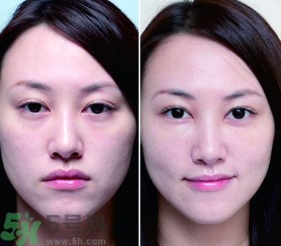 臥蠶是什么？臥蠶是眼袋嗎？