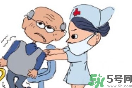 癲癇的典型癥狀有哪些？癲癇是什么？