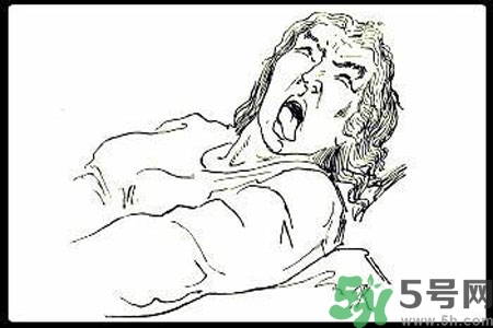 癲癇的護理措施？癲癇的飲食護理是什么？