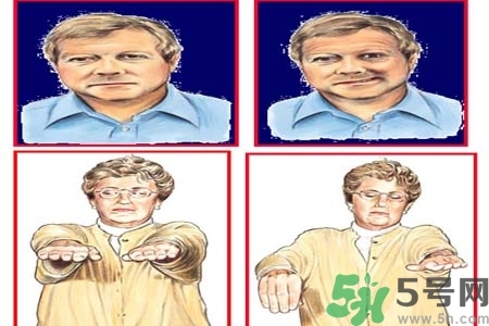 腦中風(fēng)是什么？腦中風(fēng)的癥狀？