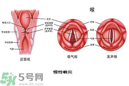 慢性咽炎是什么？慢性咽炎的癥狀有哪些？