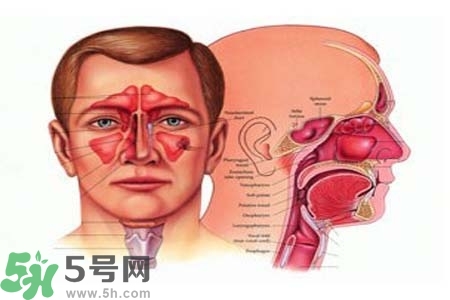 鼻竇炎的高發(fā)人群？如何預(yù)防鼻竇炎？
