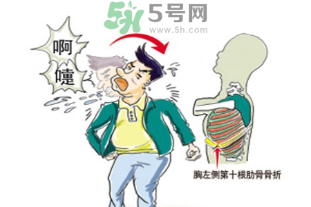 過敏性鼻炎是什么？過敏性鼻炎的癥狀有哪些？