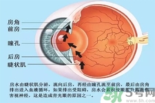 青光眼是什么？青光眼癥狀有什么？