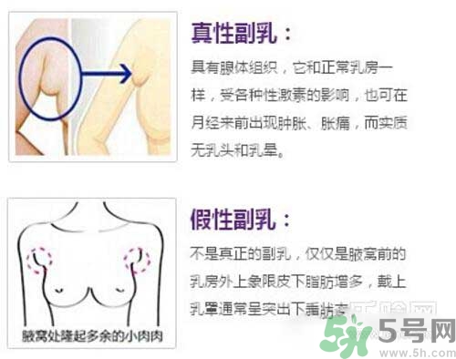 副乳是什么？副乳的危害