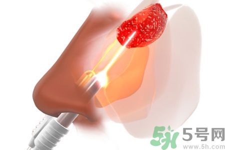 鼻咽癌的日常措施是什么？鼻咽癌注意的飲食有哪些？