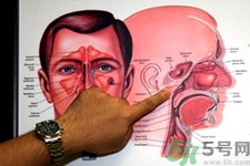 鼻咽癌的發(fā)病因素是什么？鼻咽癌的并發(fā)癥有哪些？