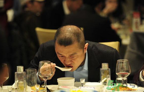 男人禿頂會遺傳嗎？男人禿頂是腎虛嗎？