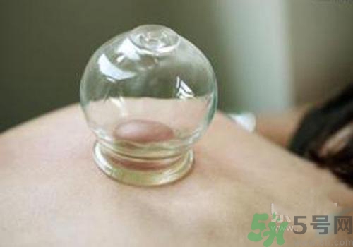 拔火罐和拔氣罐哪個(gè)好？拔火罐和拔氣罐的區(qū)別