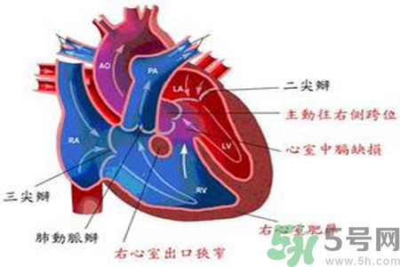 先天性心臟病需要注意什么？