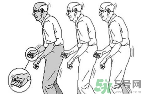 帕金森要注意哪些措施？帕金森的飲食需注意什么？