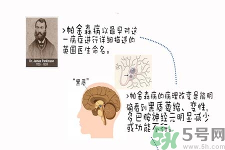帕金森的治療方法有哪些？