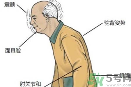 帕金森的易發(fā)人群有哪些？如何預(yù)防帕金森？